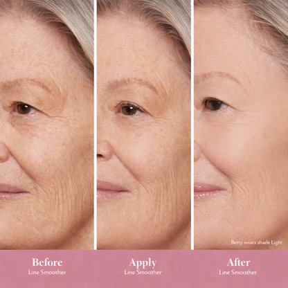 Elvéra™ Targeted Line Smoother